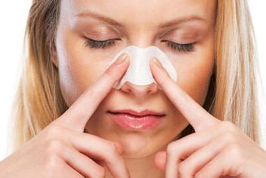 Nasal rhinoplasty