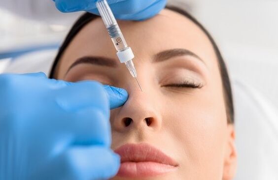 The method of non -bertogical rhinoplasty