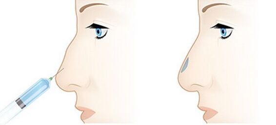 The procedure allows you to correct different problems
