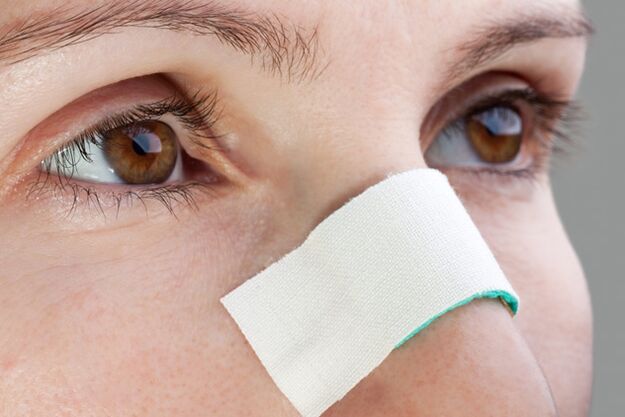 possible complications in the postoperative period of correction of the nasal septum
