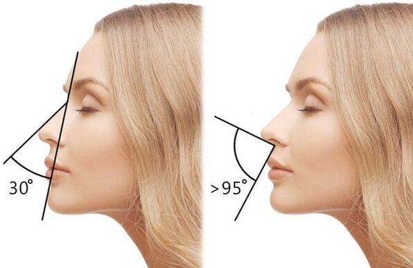 measuring the angle of the nose