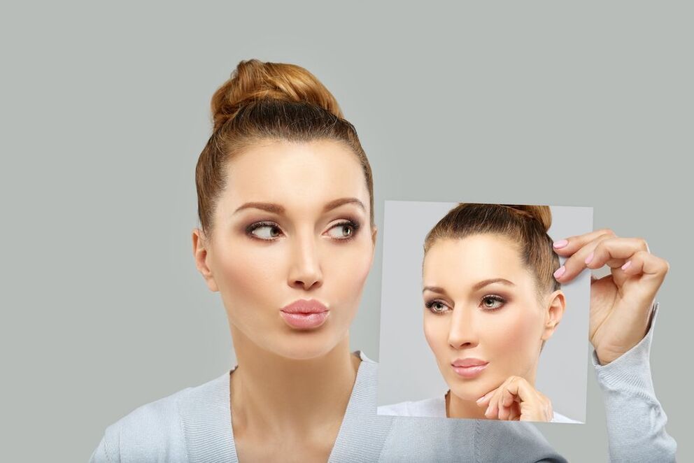 female face before and after rhinoplasty