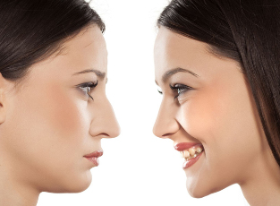 The skin of the nose pre-and post -